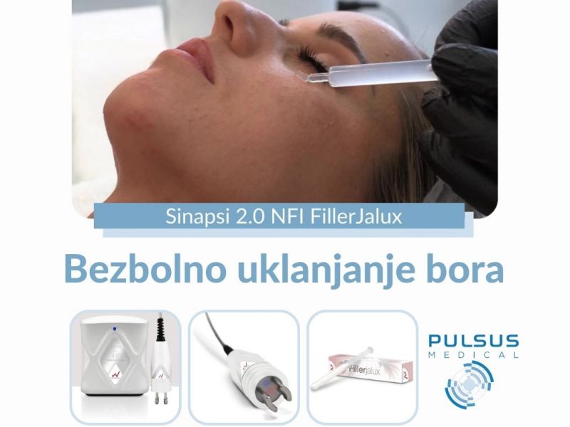Sinapsi 2.0 N-FI FillerJalux - Bezbolno uklanjanje bora