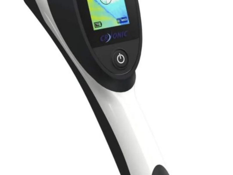 Novost u ponudi: CRYOSCREEN
