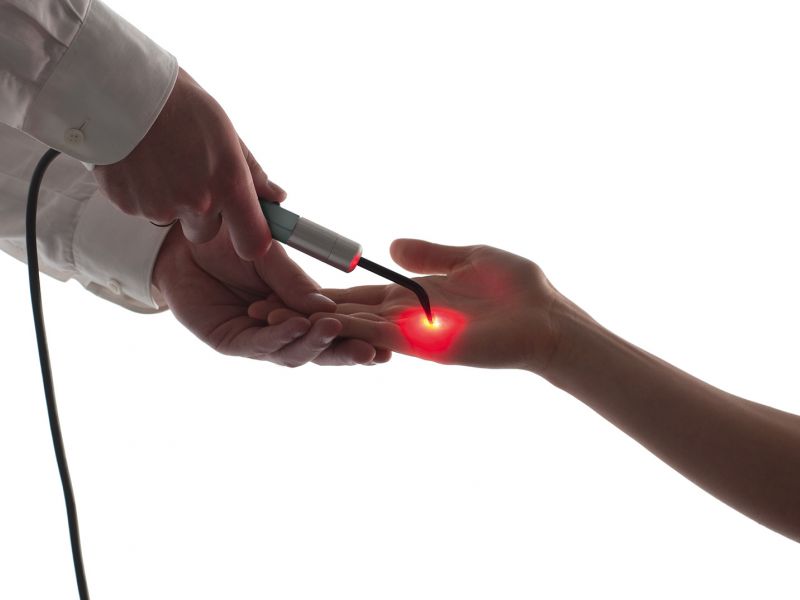 Terapija laserom