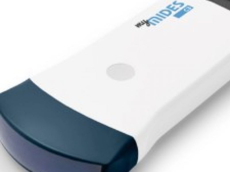 Uskoro u ponudi wireless UZV sonde