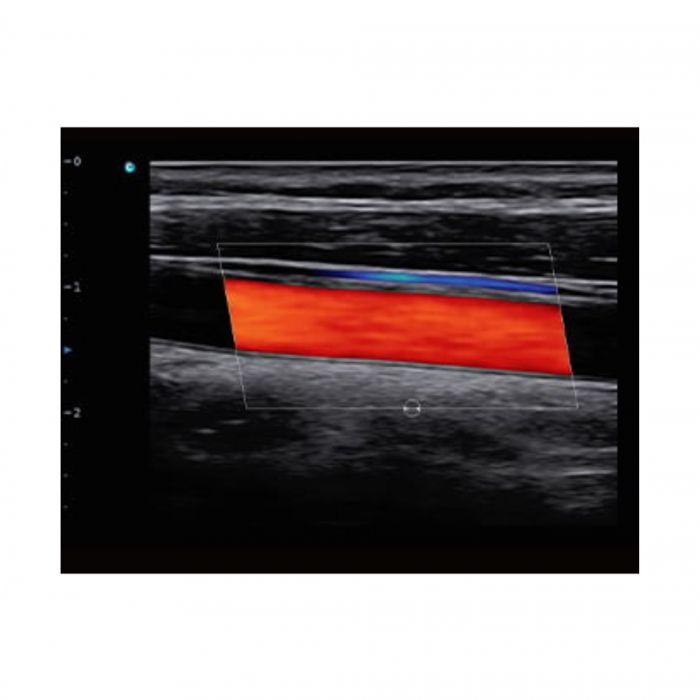 SonoAir 70 Cijena